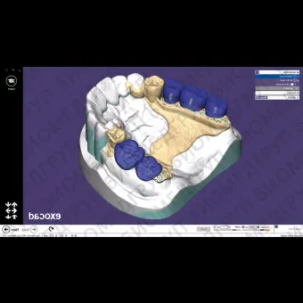 Exocad Partial Framework Module  модуль для создания бюгелей