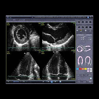 Программное обеспечение для эхокардиографии INFINITT