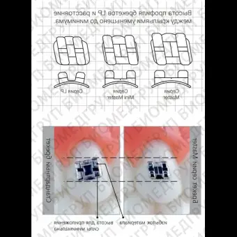 Брекеты Мини Мастер ROTH .018 LR3 АО