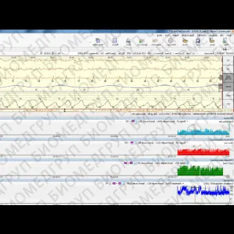 Монитор пациента для ЭЭГ NEUROMONITOR