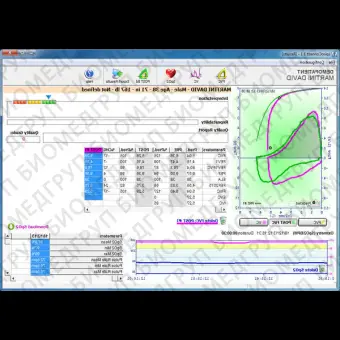 Программное обеспечение для пульсового оксиметра SpiroConnect