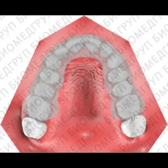 Ортодонтическое программное обеспечение Maestro 3D ortho