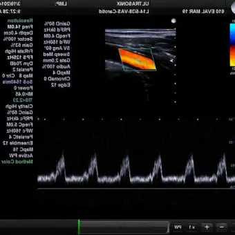 UltraSonix SonixTablet Аппарат УЗИ