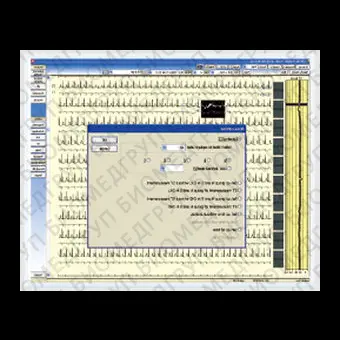 Медицинское программное обеспечение Cardy Analyzer05