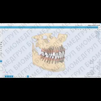 Ортодонтическое программное обеспечение Maestro 3D ortho