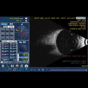 Bscan Plus Офтальмологический ультразвуковой Bсканер