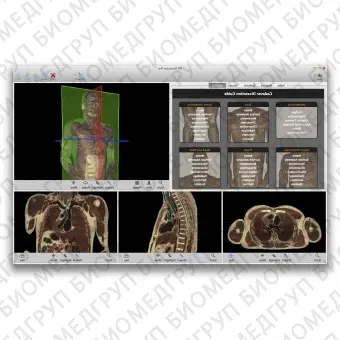 Анатомическое программное обеспечение VH Dissector for Medical Education