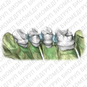 Программное обеспечение для стоматологии Restoration