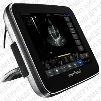 Chison SonoTouch 30 Аппарат УЗИ
