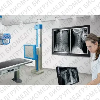 Рентгенографическая система BLUE DR