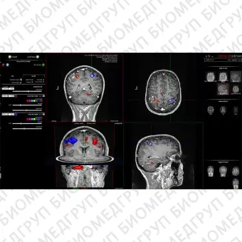 Медицинское программное обеспечение nordicBrainEx