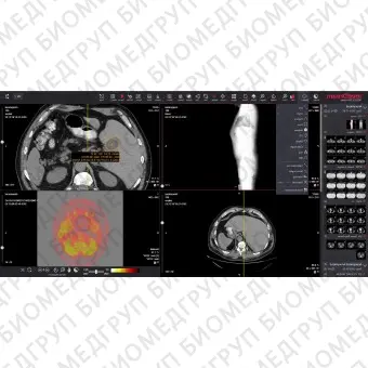 Медицинское программное обеспечение MedDream WEB DICOM