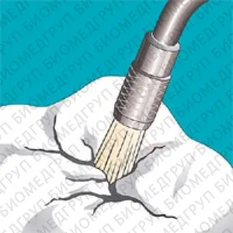 Sonicflex clean brush 4  насадкащетка конус большой для чистки зубов