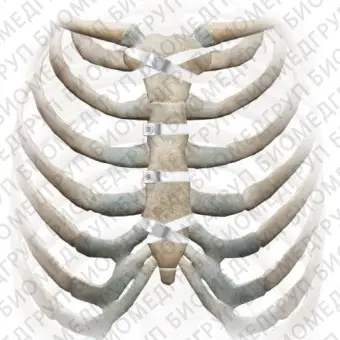 Ортопедическая проволока для закрытия груди Ortholox UHMWPE