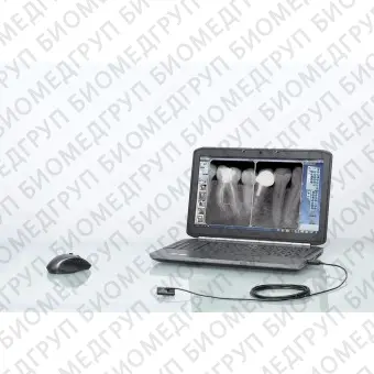Интраоральный плоскопанельный детектор для стоматологической радиографии ONE