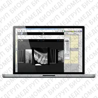 Программное обеспечение для обработки снимков зубов CS Imaging version 8