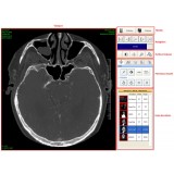 Программное обеспечение DICOM-файла Ultima Digital Illuminator