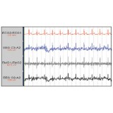 Медицинское программное обеспечение ECG Free