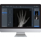 Программное обеспечение рентгенографии ADAM